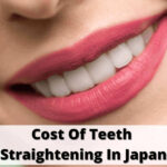 日本牙齒矯正費用