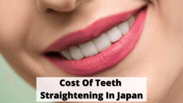 Coste del enderezamiento de los dientes en Japón