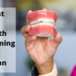 日本での歯のホワイトニングの費用