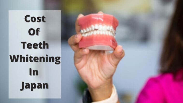 日本での歯のホワイトニングの費用
