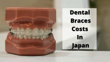日本での歯列矯正の費用