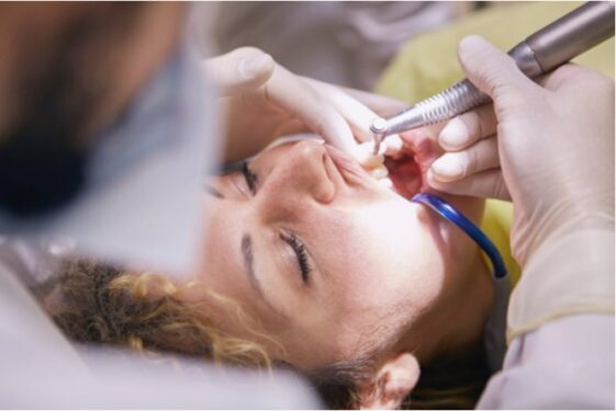 3 Types Of Teeth Whitening In Japan | Clean And Hygienic ...