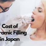 cost of ceramic filling in japan