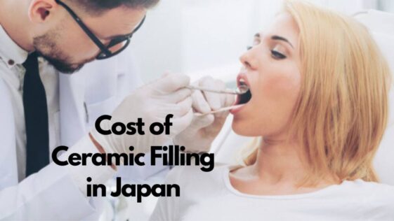 日本陶瓷填料的成本