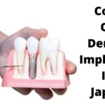 Coste de los implantes dentales en Japón (1)